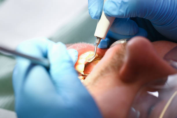 Best Pediatric Emergency Dentist in Dixon, CA